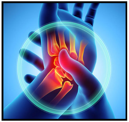 Does Omega-3 Actually Reduce Joint Pain?